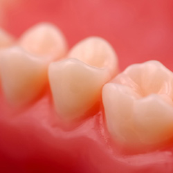 periodontal-disease-plano-texas-home